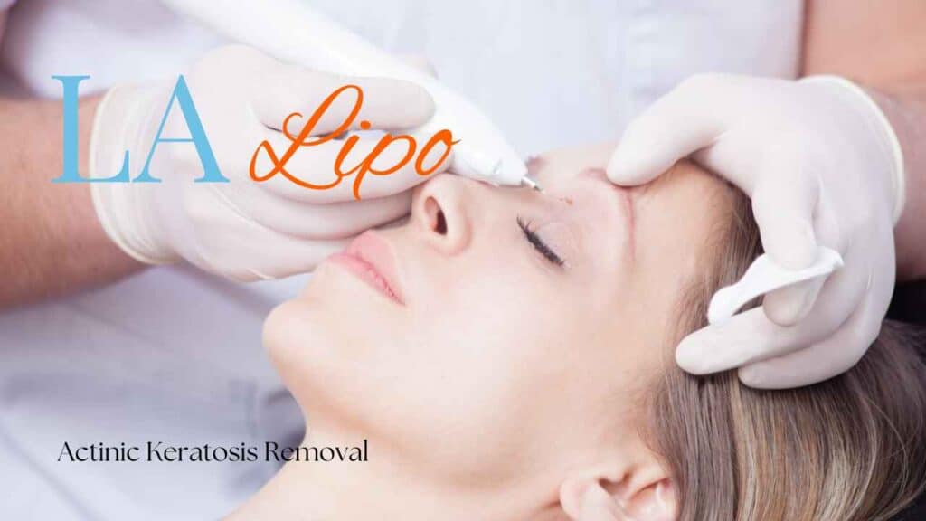 actinic keratosis removal Cambridge