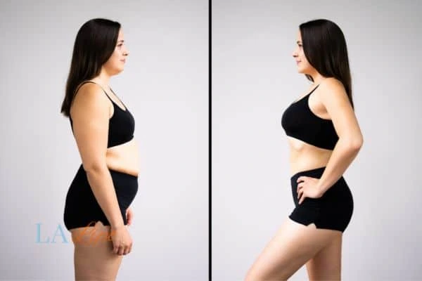 LA-EMS Body Sculpting Cambridge results before and after of womans results on body toning.