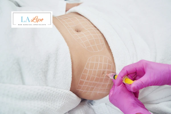 aqualyx fat dissolving injections Cambridge