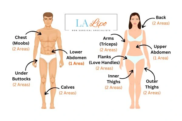 LA LIPO Cryolipolysis Areas Cambridge