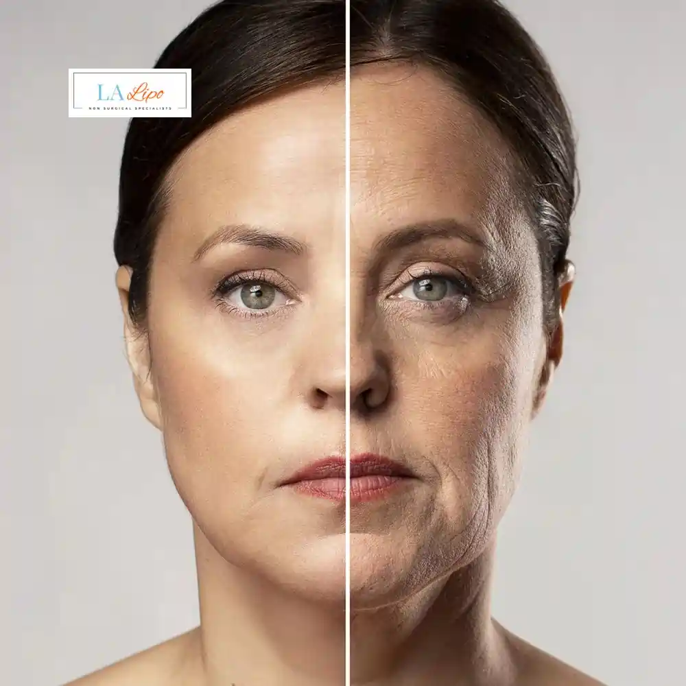 How Can You Tell If Non-Surgical Skin Tightening Is Right for You Cambridge?