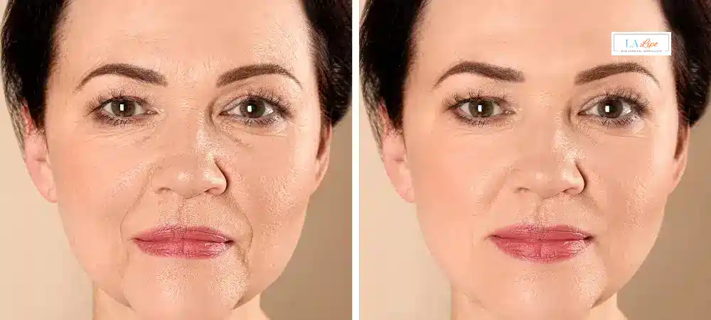 How Long Does It Take to See Results and How Long Do They Last Cambridge?