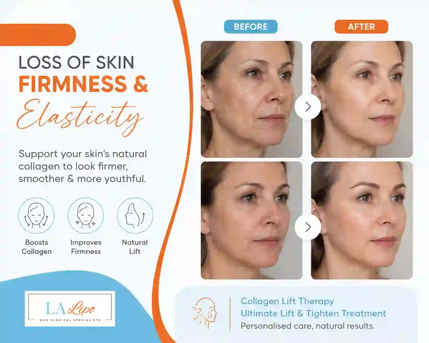 Sign #7: Loss of Skin Firmness and Elasticity Cambridge
