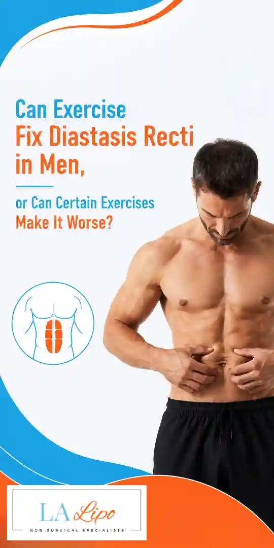 Can Exercise Fix Diastasis Recti in Men, or Can Certain Exercises Make It Worse Cambridge?
